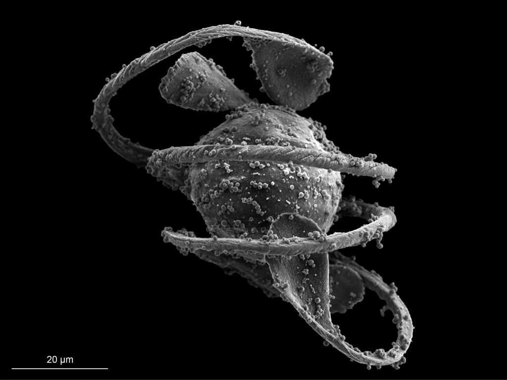 Equisetum sp_spore zatvorena2