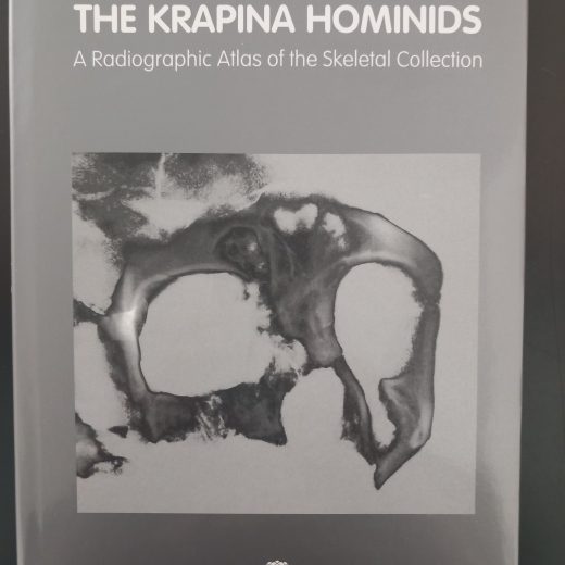 The Krapina Hominids: A Radiographic Atlas of the Skeletal Collection